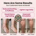 The Daily Relief Balm for Legs & Ankles