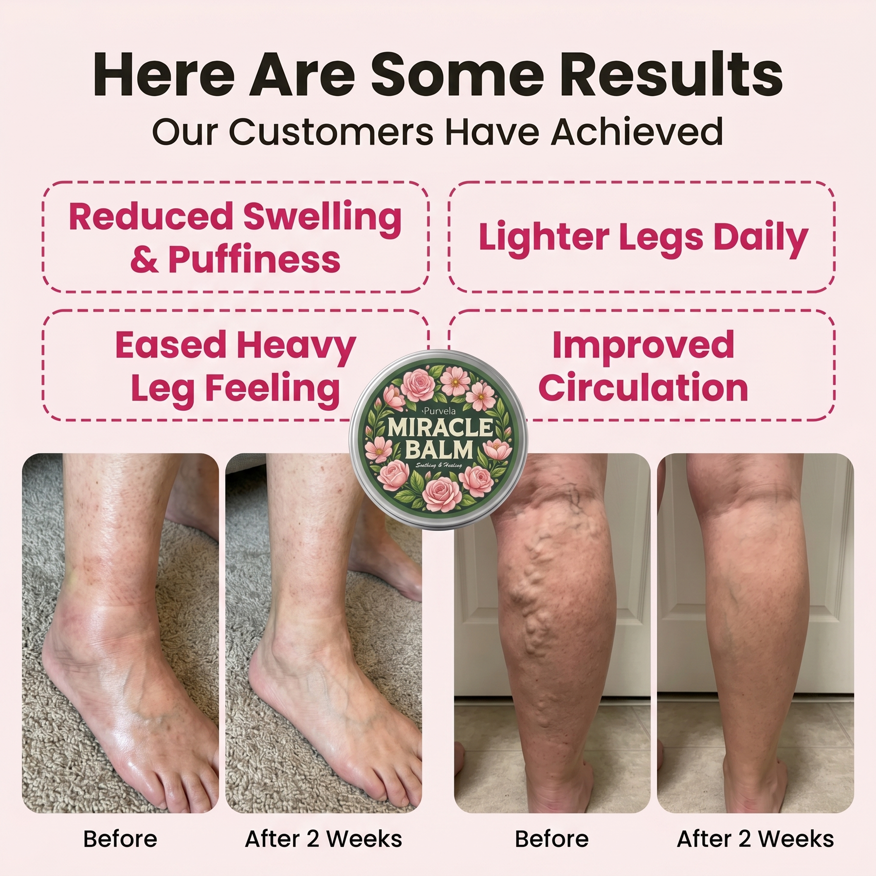 The Daily Relief Balm for Legs & Ankles